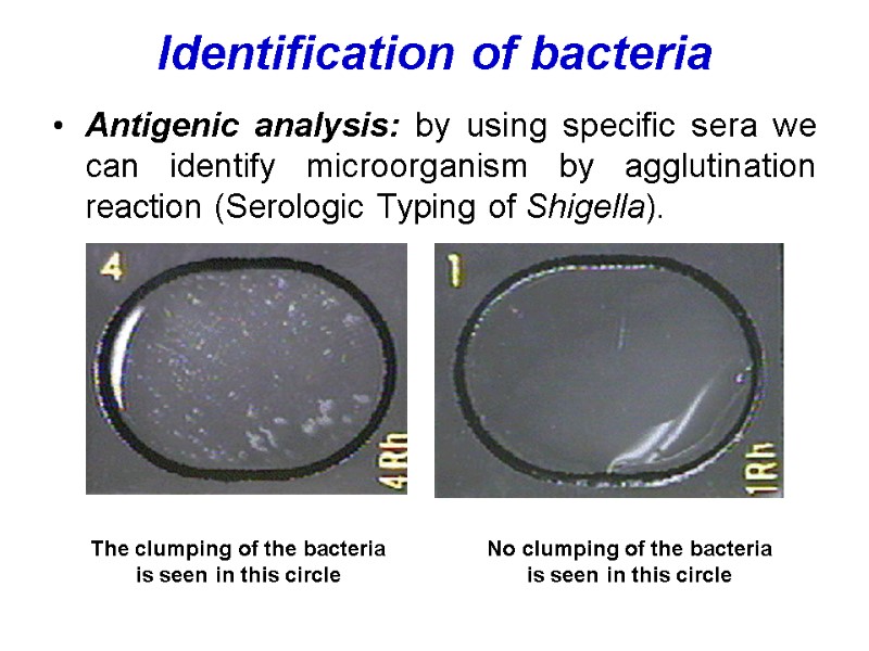 Identification of bacteria  Antigenic analysis: by using specific sera we can identify microorganism